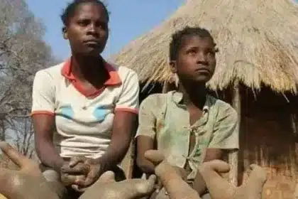 Παιδιά από φυλή στην Αφρική γεννιούνται με 2 δάχτυλα στα πόδια - Πιστεύουν πως κατάγονται από πουλιά 7