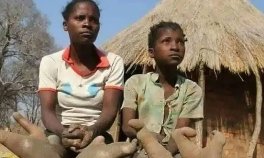 Παιδιά από φυλή στην Αφρική γεννιούνται με 2 δάχτυλα στα πόδια - Πιστεύουν πως κατάγονται από πουλιά 1